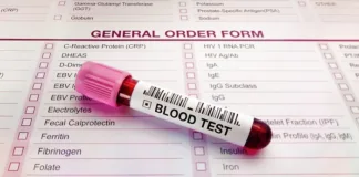 Algorithm predicts which organs age faster and will fail first – US study