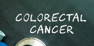 Lack of basic care hastens colorectal cancer deaths in Africa – global analysis