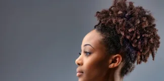 More misdiagnoses with darker skins – US study