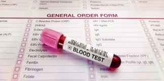 Scientists ID proteins that could predict dementia – US-China study