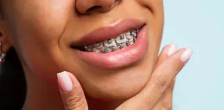 AI tool to help straighten teeth