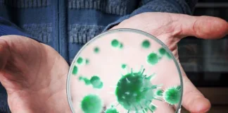 Patients’ skin bacteria tied to post-surgery infections – US study