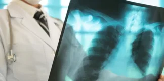 New TB framework for improved diagnosis and care