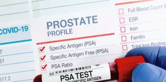 Updated guidelines for prostate cancer screening in South Africa