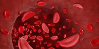 World’s first patient starts sickle cell gene therapy