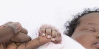 Experts call for change to skin-tone biased Apgar score