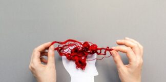 Up to 13% of dementia cases may be misdiagnosed – US cohort study