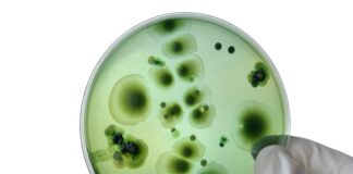 Experts flag rise of drug-resistant contagious fungus