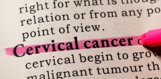 Cervical cancer treatment success with heat therapy – Wits study