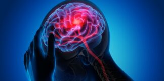 Global review identifies drug with best outcomes for stroke recovery