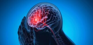 Impact of severe Covid on brain’s ‘control centre’ – UK study