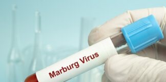 Rwanda success story in controlling Marburg outbreak