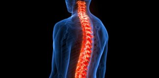 First reported case of rare spondylodiscitis in SA