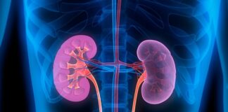 Large study identifies new kidney transplant rejection indicators