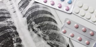 Antibiotic for MDR-TB halves risk – SA, Vietnamese trial