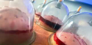 Bloodletting advised for islanders to reduce PFAS levels