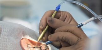 Canada’s first tooth-in-eye surgeries could restore blind man’s vision