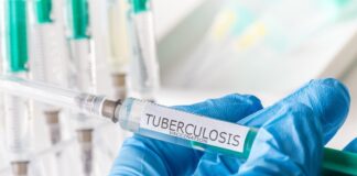 Hopes pinned on major TB vaccine study launched in Paarl