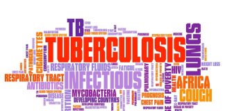 KZN research challenges TB transmission theories