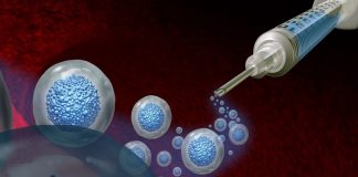 Severe diabetics ‘cured’ after new treatment – small US trial