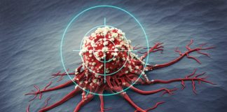 Optimism over multiple myeloma, breast cancer breakthroughs