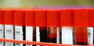French scientists identify rare new blood type