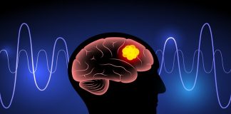 Promising Scottish scan technology for brain tumours