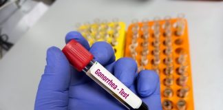 SA may have long wait for promising new gonorrhoea drugs