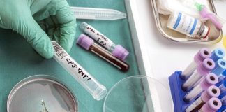 Scientists find link between genes and ME – Scottish study