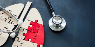 Why lung cancer is a ‘hidden epidemic’ in sub-Saharan Africa