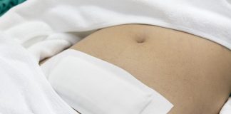 Hysterectomy ups stroke risk – meta-analysis of 2m women