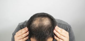 Hair-loss drug boosts hair growth by 539% – Irish study