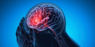 Positive results for chronic migraine treatment – Italian-Norwegian study