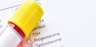 Young men targeted for unnecessary testosterone tests – Danish study