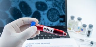 Hidden mpox exposure found in healthy Nigerians – Cambridge study