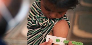 High deaths rates among starving Limpopo children – Wits study