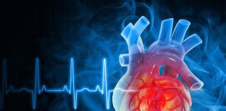 Heart disease in young women likely to spike by 2050 – US study