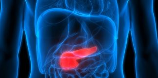 When to operate on a pancreatic cyst