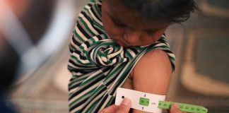 South Africa’s shame of child stunting and its echoes of HIV