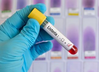 Court orders release of medical records in listeriosis case