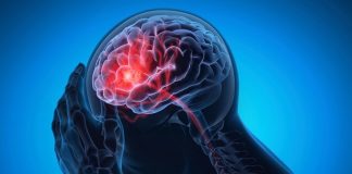 New blood-thinner cuts TIA risk – global trial