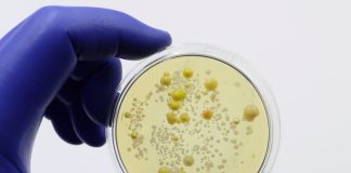 Wits contributes to global trial on best antibiotics for bloodstream infection