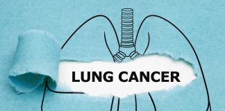 British lung cancer patient first in world to get new vaccine