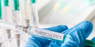 Game-changer new vaccine will eliminate TB public health threat
