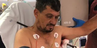 Cape Town trauma team’s skill saves impaled man’s life