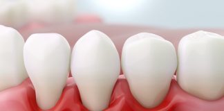 Common gum issue raises Alzheimer’s risk by 61% – Japanese study
