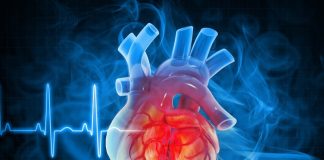 Major changes to heart attack classification