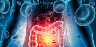 Colorectal cancer procedures show unequal care access – SA study