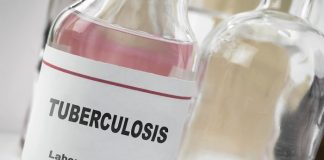 Omega-3 fatty acids could boost TB recovery – SA study